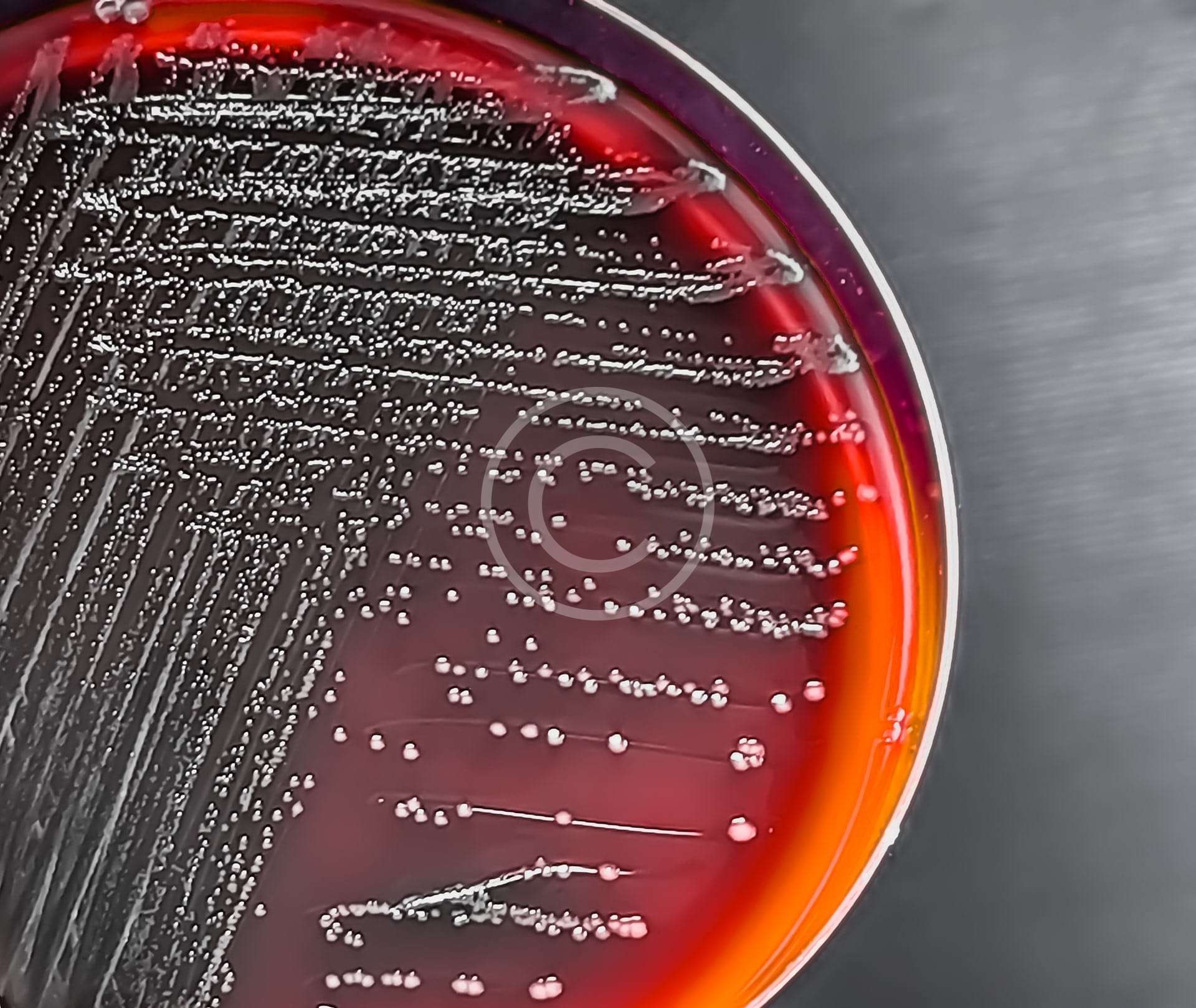 Alturon Technology Implementation